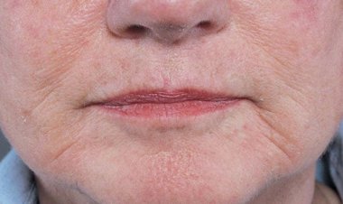 Unhealthy Food for Skin: वक्त से पहले ही बुढ़ापा ला देते हैं ये 4 फूड्स, आज ही कर लें तौबा; वरना पछताने को होंगे मजबूर