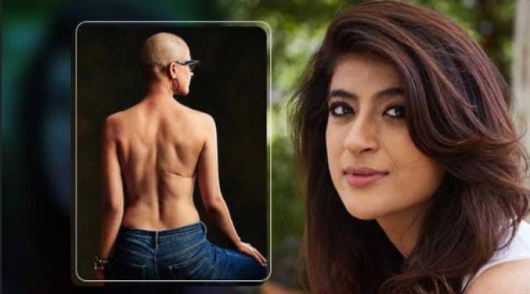 World Cancer Day पर आयुष्माम खुराना ने शेयर की ताहिरा की पुरानी तस्वीर, लिखा ये इमोशनल मैसेज