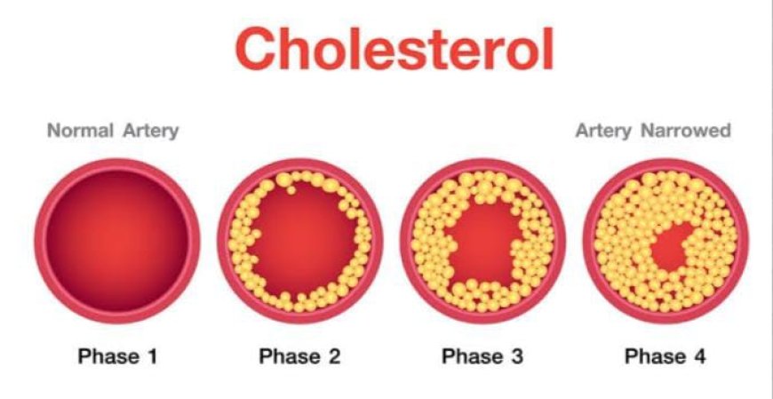 Signs of High Cholesterol At Night